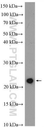 KRAS-2B Antibody in Western Blot (WB)