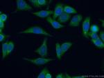 KRAS-2B Antibody in Immunocytochemistry (ICC/IF)