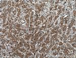 KRAS-2B Antibody in Immunohistochemistry (Paraffin) (IHC (P))