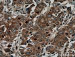 KRAS-2B Antibody in Immunohistochemistry (Paraffin) (IHC (P))