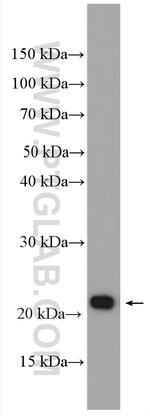 KRAS-2B Antibody in Western Blot (WB)