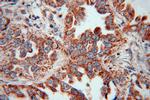 KRAS-2A Antibody in Immunohistochemistry (Paraffin) (IHC (P))