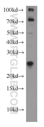 KRAS-2A Antibody in Western Blot (WB)