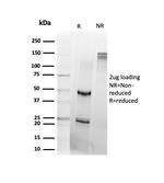 DAXX Antibody in SDS-PAGE (SDS-PAGE)