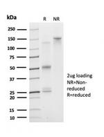 DAXX (Transcriptional Corepressor) Antibody in Immunoelectrophoresis (IE)