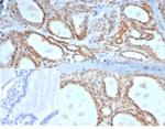 DAXX (Transcriptional Corepressor) Antibody in Immunohistochemistry (Paraffin) (IHC (P))