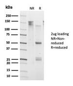 DAXX (Transcriptional Corepressor) Antibody in Immunoelectrophoresis (IE)