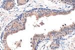 Presenilin-1 Antibody in Immunohistochemistry (Paraffin) (IHC (P))