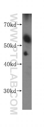 Presenilin-1 Antibody in Western Blot (WB)