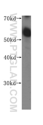 Presenilin-1 Antibody in Western Blot (WB)