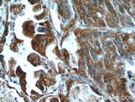 HDAC4 Antibody in Immunohistochemistry (Paraffin) (IHC (P))