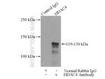 HDAC4 Antibody in Immunoprecipitation (IP)