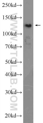 HDAC4 Antibody in Western Blot (WB)