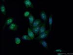 HDAC5 Antibody in Immunocytochemistry (ICC/IF)