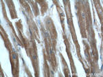 HDAC5 Antibody in Immunohistochemistry (Paraffin) (IHC (P))