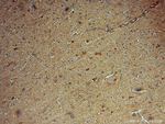 HDAC5 Antibody in Immunohistochemistry (Paraffin) (IHC (P))