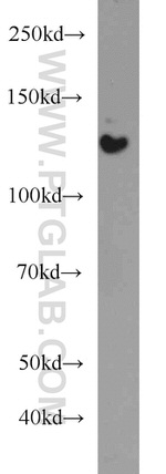 HDAC5 Antibody in Western Blot (WB)