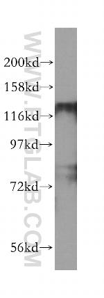 HDAC5 Antibody in Western Blot (WB)