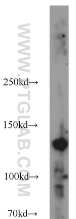 HDAC5 Antibody in Western Blot (WB)