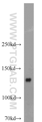 HDAC5 Antibody in Western Blot (WB)