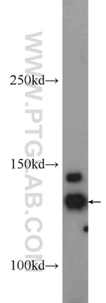 HDAC5 Antibody in Western Blot (WB)