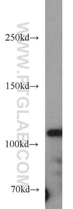 HDAC6 Antibody in Western Blot (WB)