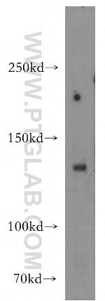 HDAC6 Antibody in Western Blot (WB)