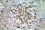 PSEN2 Antibody in Immunohistochemistry (Paraffin) (IHC (P))