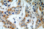 PSEN2 Antibody in Immunohistochemistry (Paraffin) (IHC (P))