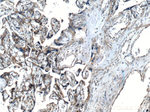 PSEN2 Antibody in Immunohistochemistry (Paraffin) (IHC (P))