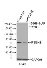 PSEN2 Antibody in Western Blot (WB)