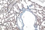 Icam-1 Antibody in Immunohistochemistry (Paraffin) (IHC (P))