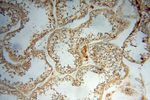 Lin28A Antibody in Immunohistochemistry (Paraffin) (IHC (P))