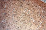 Lin28A Antibody in Immunohistochemistry (Paraffin) (IHC (P))