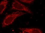 Lin28B Antibody in Immunocytochemistry (ICC/IF)