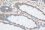 Lin28B Antibody in Immunohistochemistry (Paraffin) (IHC (P))