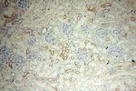 Lin28B Antibody in Immunohistochemistry (Paraffin) (IHC (P))