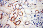 Lin28B Antibody in Immunohistochemistry (Paraffin) (IHC (P))