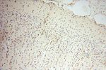 Lin28B Antibody in Immunohistochemistry (Paraffin) (IHC (P))