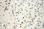 Lin28B Antibody in Immunohistochemistry (Paraffin) (IHC (P))