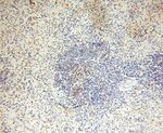 Lin28B Antibody in Immunohistochemistry (Paraffin) (IHC (P))