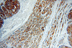 Lin28B Antibody in Immunohistochemistry (Paraffin) (IHC (P))