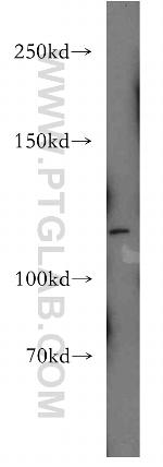 Palladin Antibody in Western Blot (WB)