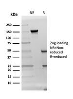 DAZL (Deleted in Azoospermia-like) Antibody in SDS-PAGE (SDS-PAGE)