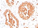 DAZL (Deleted in Azoospermia-like) Antibody in Immunohistochemistry (Paraffin) (IHC (P))