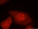 MYPN Antibody in Immunocytochemistry (ICC/IF)