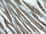 MYPN Antibody in Immunohistochemistry (Paraffin) (IHC (P))