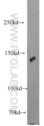 MYPN Antibody in Western Blot (WB)