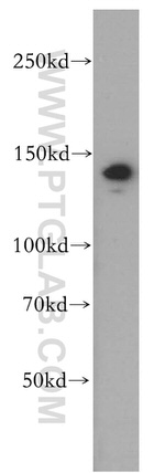 MYPN Antibody in Western Blot (WB)