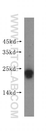 RAB22A Antibody in Western Blot (WB)